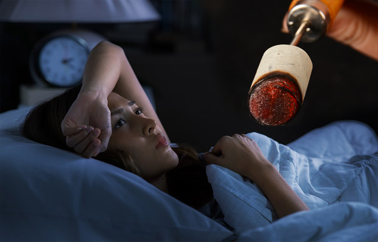 Cứu điều trị mất ngủ, rối loạn giấc ngủ, mất ngủ không thực tổn (Thất miên)